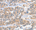 CGB Polyclonal Antibody – Figure 1 of 3