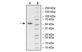 4-20% SDS-PAGE Coomassie Staining