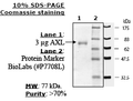 Axl, GST-Tag Recombinant – Figure 1 of 1