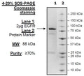 EGFR, GST-tag, His-tag, Recombinant – Figure 1 of 2
