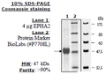 EPHA2, His-tag Recombinant – Figure 1 of 1