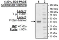 IRAK1, His-Tag Recombinant – Figure 1 of 2