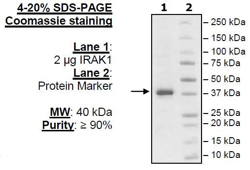 IRAK1, His-Tag Recombinant – Figure 1 of 2