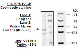 cKit, His-tag Recombinant – Figure 1 of 6