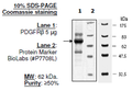 PDGFRβ, His-tag Recombinant – Figure 1 of 2