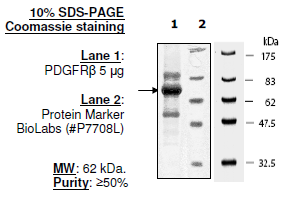 PDGFRβ, His-tag Recombinant – Figure 1 of 2
