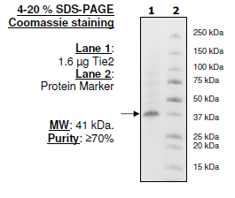 Tie2, His-tag Recombinant – Figure 1 of 2