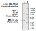 Abl Kinase, His-tag Recombinant – Figure 1 of 4
