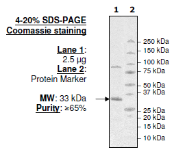 Abl Kinase, His-tag Recombinant – Figure 1 of 4