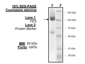 FES, His-FLAG-tag Recombinant – Figure 1 of 2