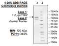 PYK2, His-tag Recombinant – Figure 1 of 2