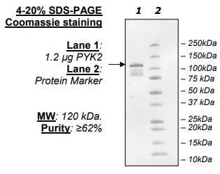 PYK2, His-tag Recombinant – Figure 1 of 2