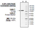 ZAP70, GST-tag Recombinant – Figure 1 of 2