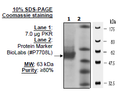 PKLR Var1 (PKR), His-tag Recombinant – Figure 1 of 2