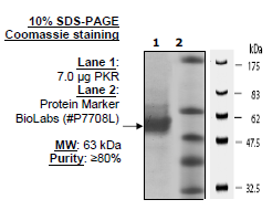 PKLR Var1 (PKR), His-tag Recombinant – Figure 1 of 2