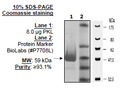 PKLR Var2 (PKL), His-tag Recombinant – Figure 1 of 2