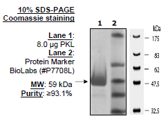 PKLR Var2 (PKL), His-tag Recombinant – Figure 1 of 2
