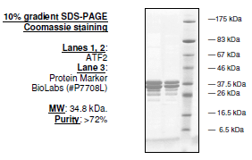 ATF2, GST-Tag Recombinant – Figure 1 of 1