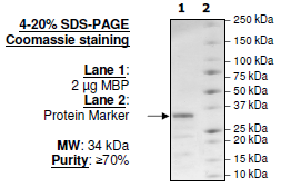 MBP, His-Tag Recombinant – Figure 1 of 2