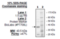 RB, GST-tag Recombinant – Figure 1 of 1