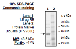 RB, GST-tag Recombinant – Figure 1 of 1