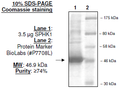 Sphingosine kinase 1, His-tag Recombinant – Figure 1 of 4