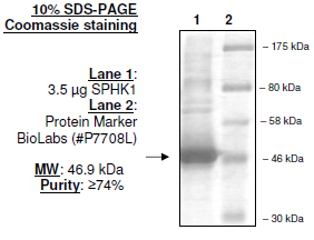 Sphingosine kinase 1, His-tag Recombinant – Figure 1 of 4