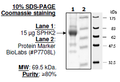 Sphingosine kinase 2, His-tag Recombinant – Figure 1 of 1