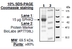 Sphingosine kinase 2, His-tag Recombinant – Figure 1 of 1