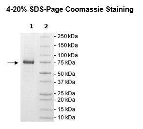 Sphingosine Kinase 2 (Transcript Variant 1), His-Tag Recombinant – Figure 1 of 2