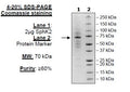 Mouse Sphingosine kinase 2, His-tag Recombinant – Figure 1 of 2