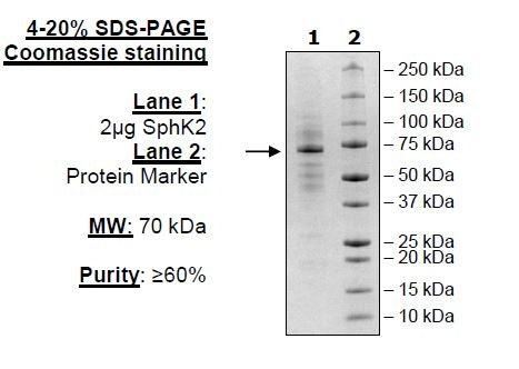 Mouse Sphingosine kinase 2, His-tag Recombinant – Figure 1 of 2