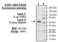 IP6K2, Biotin-labeled, His-tag, Avi-tag Recombinant – Figure 1 of 2