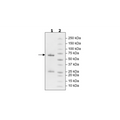 TGFβR2, GST-tag Recombinant – Figure 1 of 1