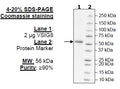 VSIG8, Fc Fusion, Avi-Tag Recombinant – Figure 1 of 1