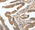 CKAP2 Polyclonal Antibody – Figure 1 of 3