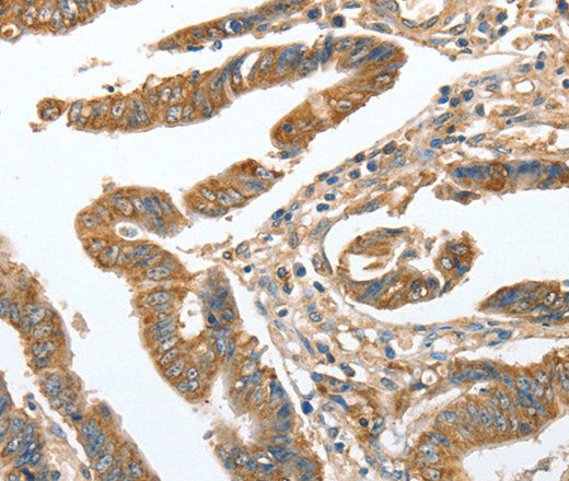 CKAP2 Polyclonal Antibody – Figure 1 of 3