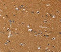 CHRNA4 Polyclonal Antibody – Figure 1 of 2