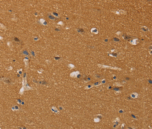 CHRNA4 Polyclonal Antibody – Figure 1 of 2