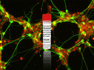 Human Motor Neurons (iPSC-derived, Normal) – Figure 1 of 1