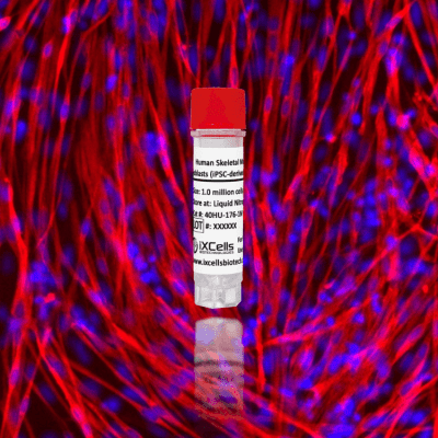 Human Skeletal Muscle Myoblasts (iPSC-derived, Normal)