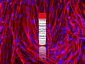 Human Skeletal Muscle Myoblasts (iPSC-derived, SOD1 mutant, A4V, HOM) – Figure 1 of 1