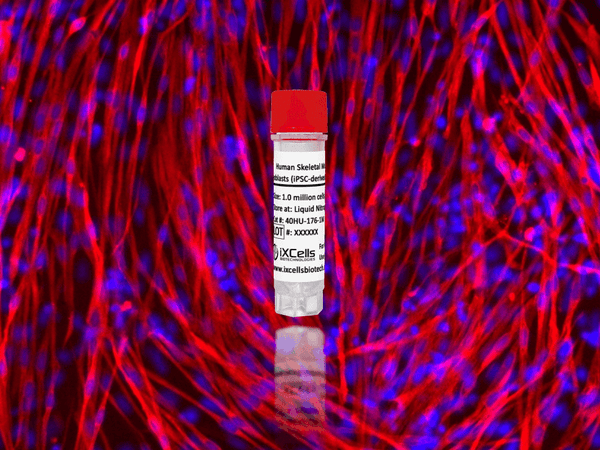 Human Skeletal Muscle Myoblasts (iPSC-derived, SOD1 mutant, A4V, HOM) – Figure 1 of 1