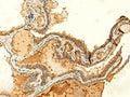 KIAA0513 Polyclonal Antibody – Figure 1 of 3