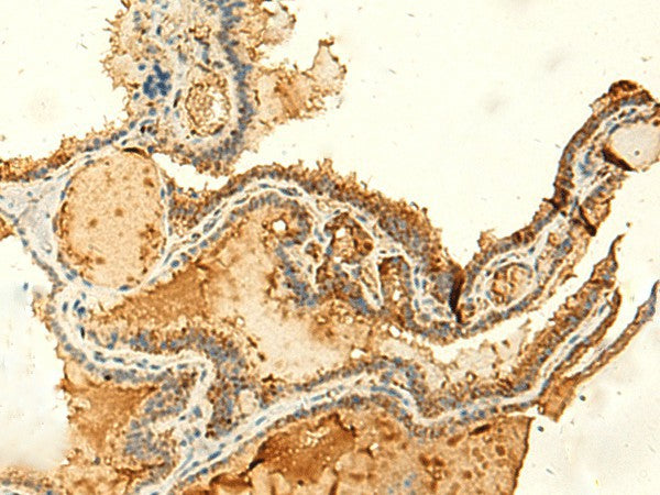 KIAA0513 Polyclonal Antibody – Figure 1 of 3