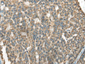 BLNK Polyclonal Antibody – Figure 1 of 3