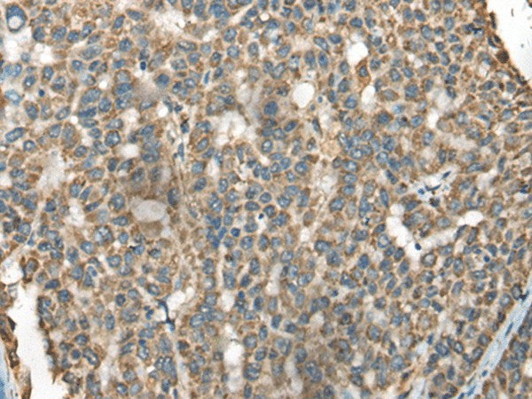 BLNK Polyclonal Antibody – Figure 1 of 3