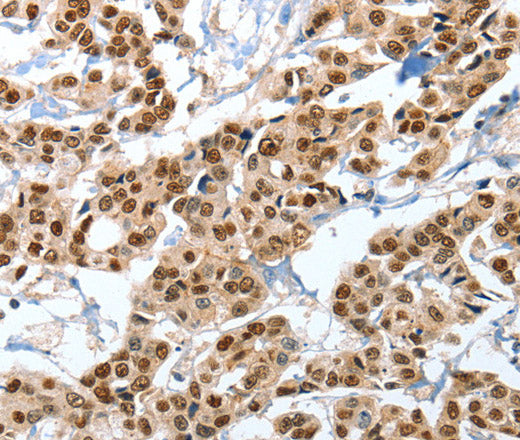 ANXA10 Polyclonal Antibody – Figure 1 of 3