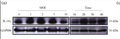 IL1F9 Antibody – Figure 1 of 3
