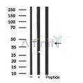 Kir6.2 Antibody – Figure 1 of 5
